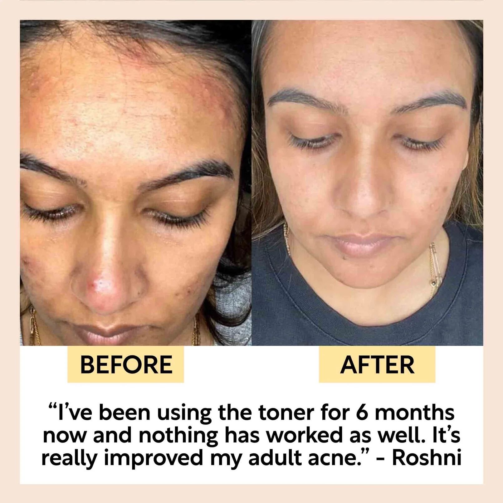 UpCircle Travel Toner - Image 3